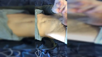 5dcedf4cc84f761a921eb Source video